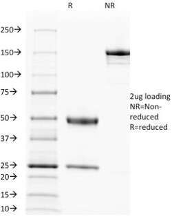 EGFR Antibody (31G7), Novus Biologicals 0.2mg; Unlabeled:Antibodies, Monoclonal
